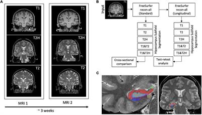 Comparison and Reliability of Hippocampal Subfield Segmentations Within FreeSurfer Utilizing T1- and T2-Weighted Multispectral MRI Data